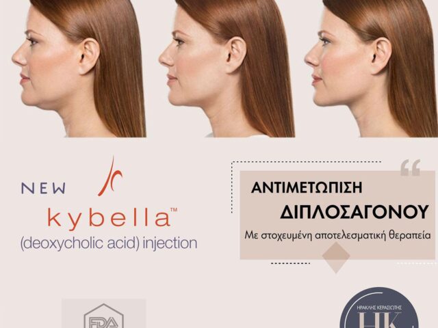 New Kybella Injection