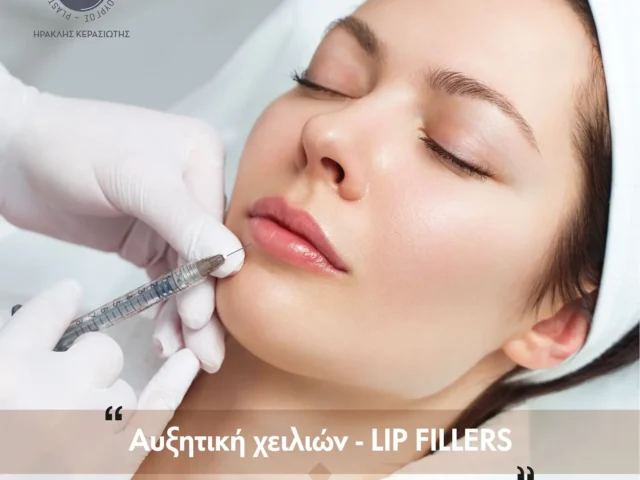 LIP FILLERS