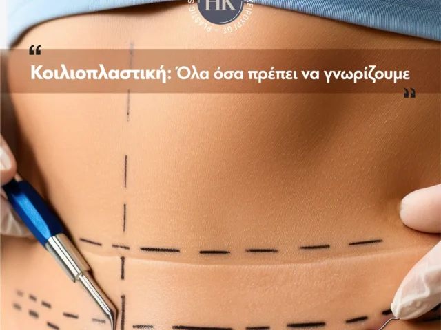 Κοιλιοπλαστική: Όλα όσα πρέπει να γνωρίζουμε